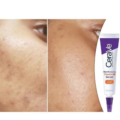 Luxora Radiance C+ Serum