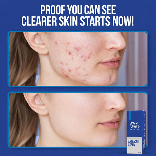 “WIKI SPECIAL | Acne Serum”